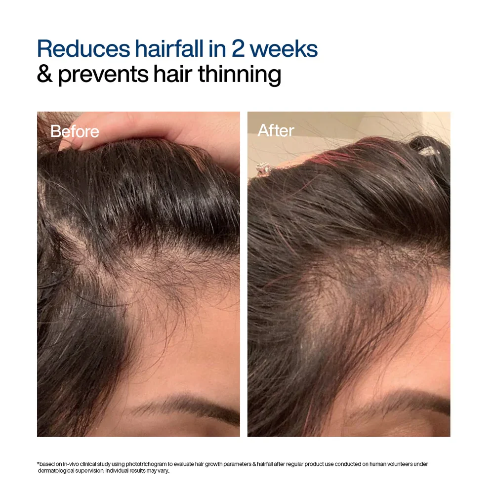 Wish Care Hair Growth Serum Concentrate Roll-On - Image 3