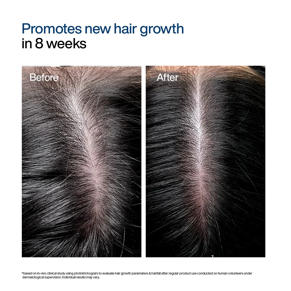 Wish Care Hair Growth Serum Concentrate Roll-On - Image 4